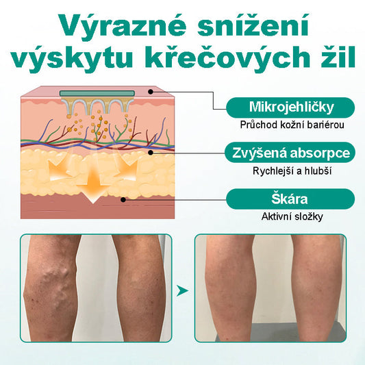CleraNaure® LegRenew Náplast na Křečové Žíly