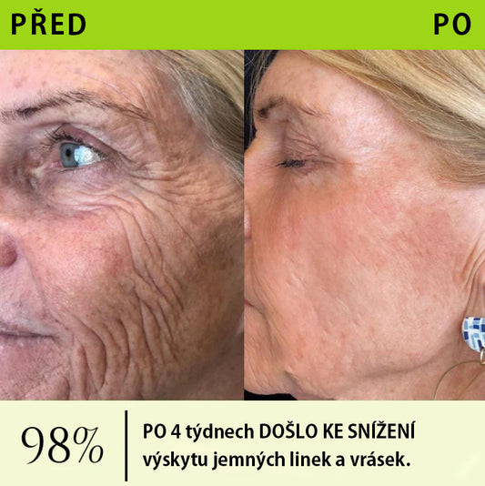 CleraNaure® – sérum s botox-like peptidy a retinolem (Retinol Shot)