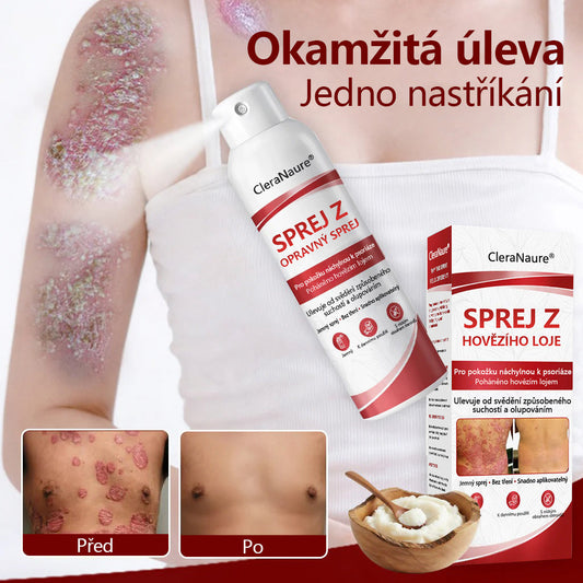 🔴CleraNature® Sprej s Hovězím Tvarohem pro Svědící, Olupující se Pokožku Při Psoriáze