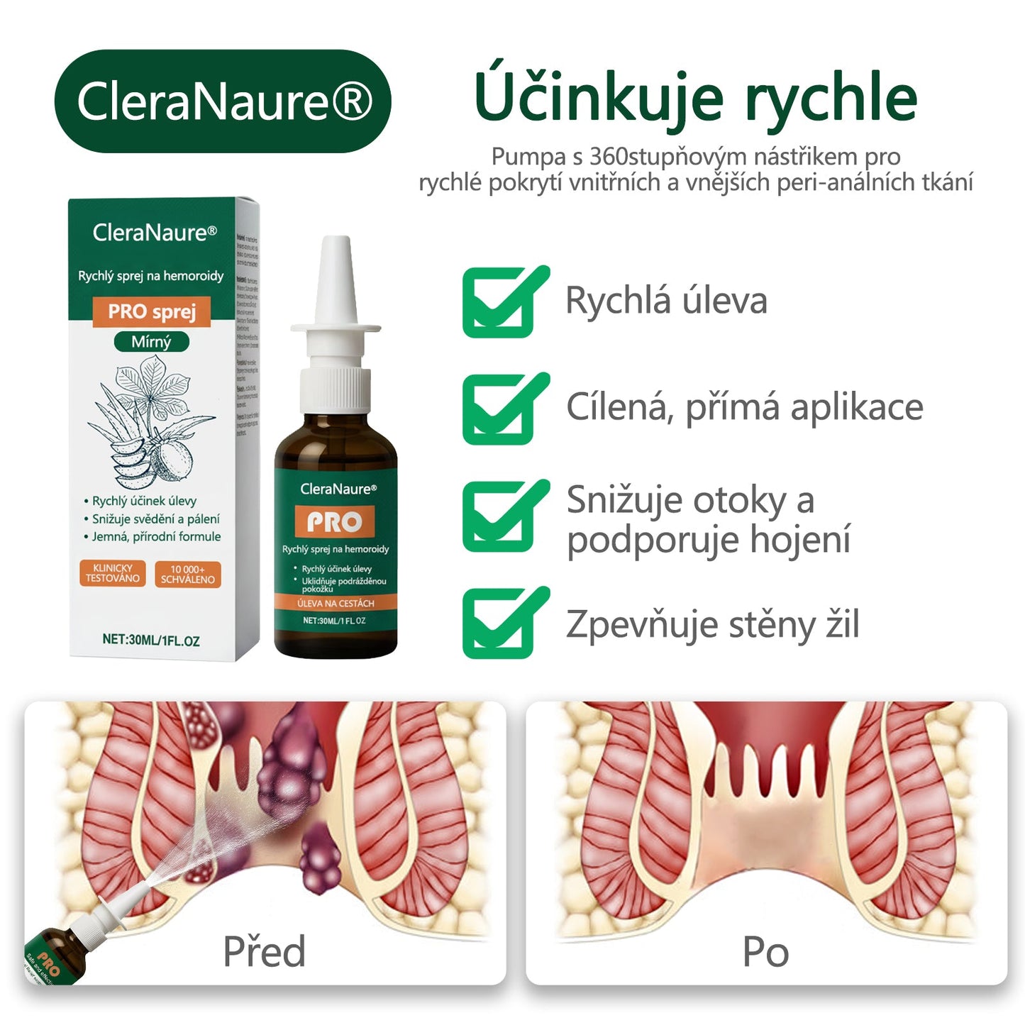 💎CleraNaure® Rychlý Hemoroidní PRO Sprej💎