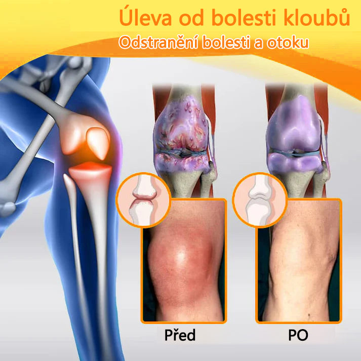 ⭐CleraNaure® Krém s včelím jedem pro úlevu od bolesti a hojení kostí