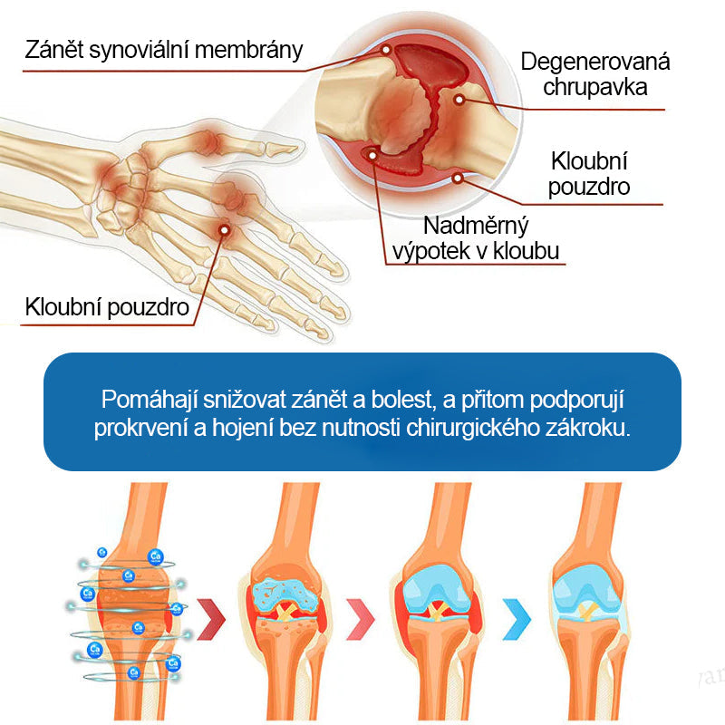 💎 Poslední den akce 80% SLEVA |  CleraNaure® BPC-157 Krém na hojení kloubů🦴Léčí artritidu, neuropatii, revmatismus, sportovní úrazy a další