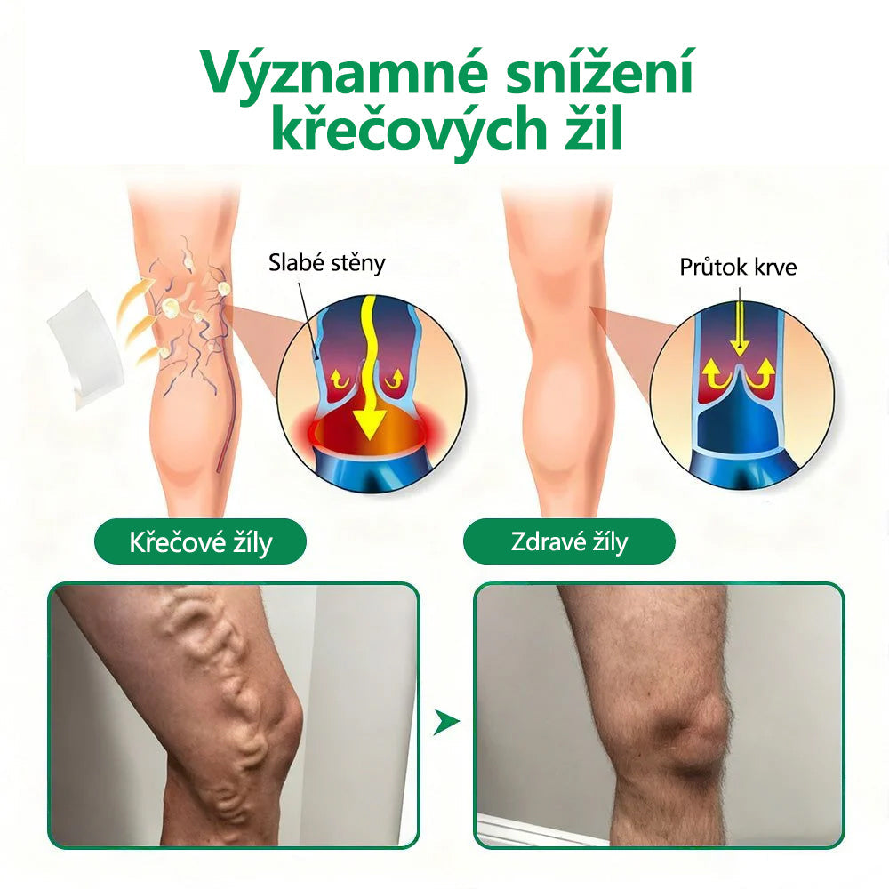 CleraNaure® VeinTarget Mikroneedling Obvaz