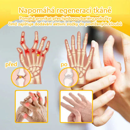 ⭐CleraNaure® Krém s včelím jedem pro úlevu od bolesti a hojení kostí