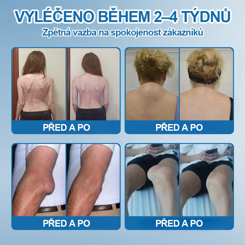 💎 Poslední den akce 80% SLEVA |  CleraNaure® BPC-157 Krém na hojení kloubů🦴Léčí artritidu, neuropatii, revmatismus, sportovní úrazy a další