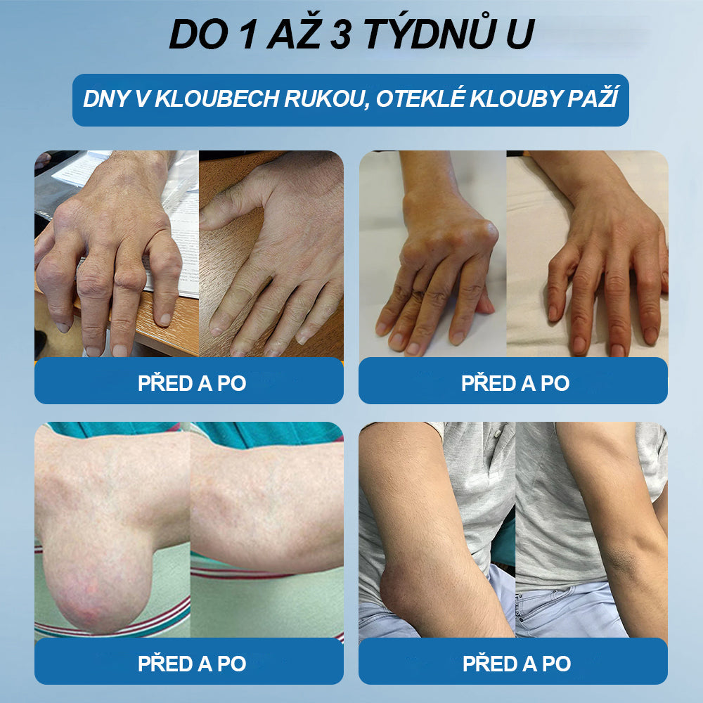 💎 Poslední den akce 80% SLEVA |  CleraNaure® BPC-157 Krém na hojení kloubů🦴Léčí artritidu, neuropatii, revmatismus, sportovní úrazy a další