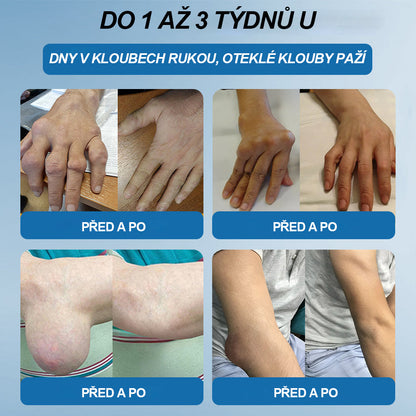 💎 Poslední den akce 80% SLEVA |  CleraNaure® BPC-157 Krém na hojení kloubů🦴Léčí artritidu, neuropatii, revmatismus, sportovní úrazy a další