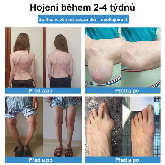 CleraNaure® Nano-microneedle kloubní náplast