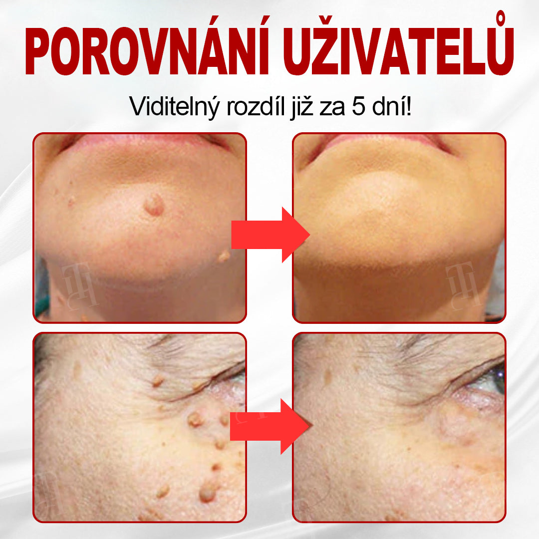 CleraNaure® WartAway Pro
