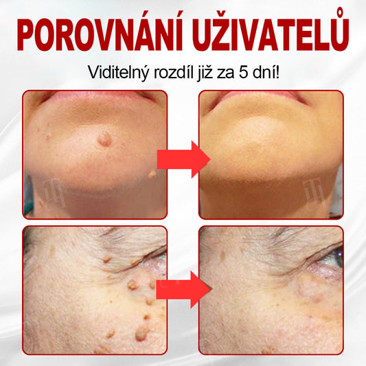 🛡️CleraNaure® WartAway Pro