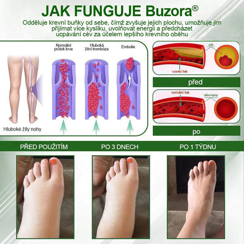 🌿Buzora® Bylinný krém zmírňující otoky s černuchou🎁