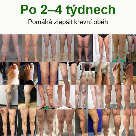 🛡️CleraNaure® Profesionální krém na nohy pro lepší cirkulaci