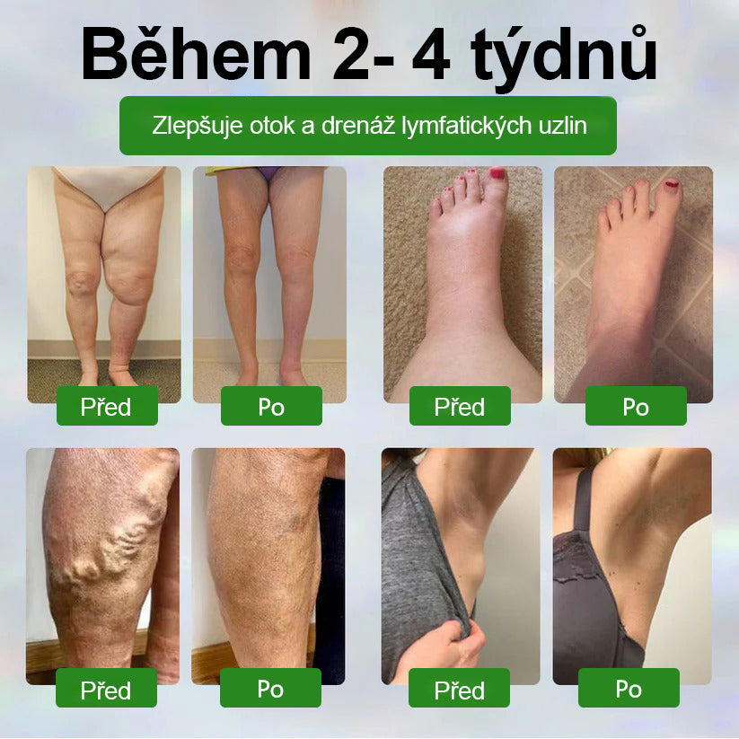 🌿Buzora® Bylinný krém zmírňující otoky s černuchou🎁