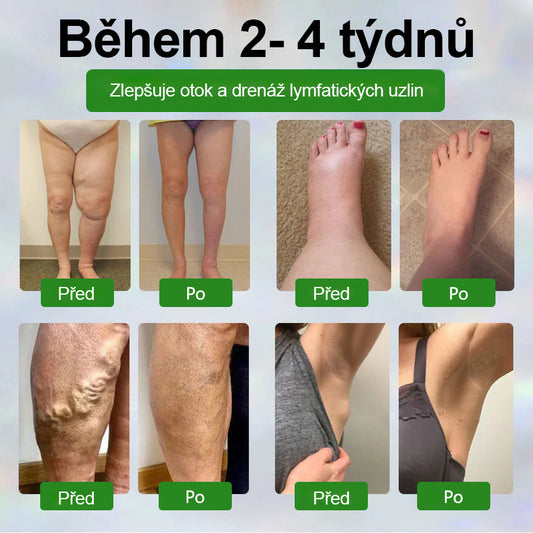🌿Buzora® Bylinný krém zmírňující otoky s černuchou