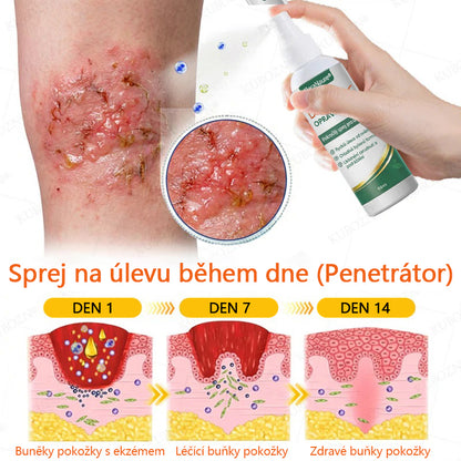 CleraNaure® Systém pro denní a noční péči o ekzémy –⚡ dvojbalení bez steroidů pro úlevu od intenzivního svědění, zarudnutí a porušené pokožky (akční nabídka)- 🌻