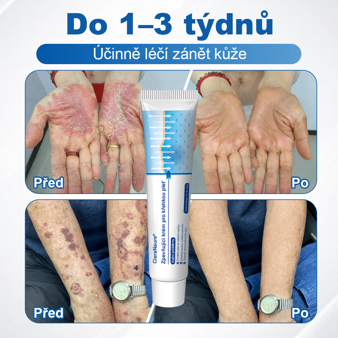 CleraNaure® – Regenerační krém pro oslabenou pleť 🛡️🌿 Multifunkční oprava proti modřinám, suchosti a skvrnám