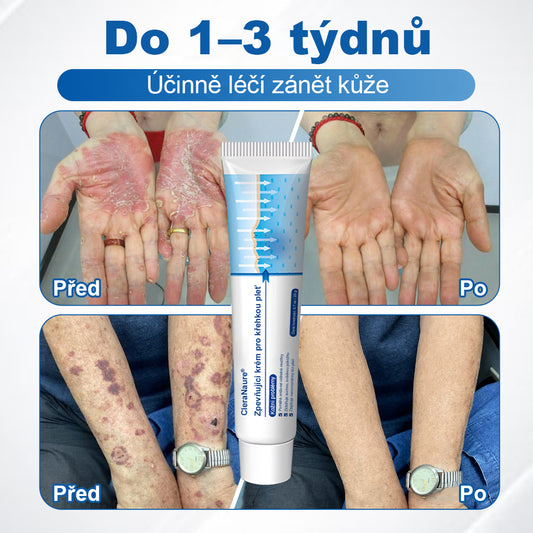 🛡️CleraNaure® – Regenerační krém pro oslabenou pleť 🛡️🌿 Multifunkční oprava proti modřinám, suchosti a skvrnám