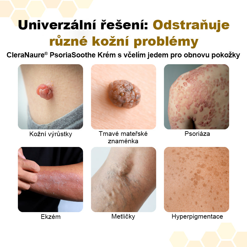 🛡️CleraNaure® PsoriaSoothe – regenerační krém s včelím jedem pro obnovu pleti