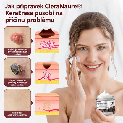 💎 CleraNaure® KeraErase - Krém s dvojitým účinkem pro obnovu pokožky