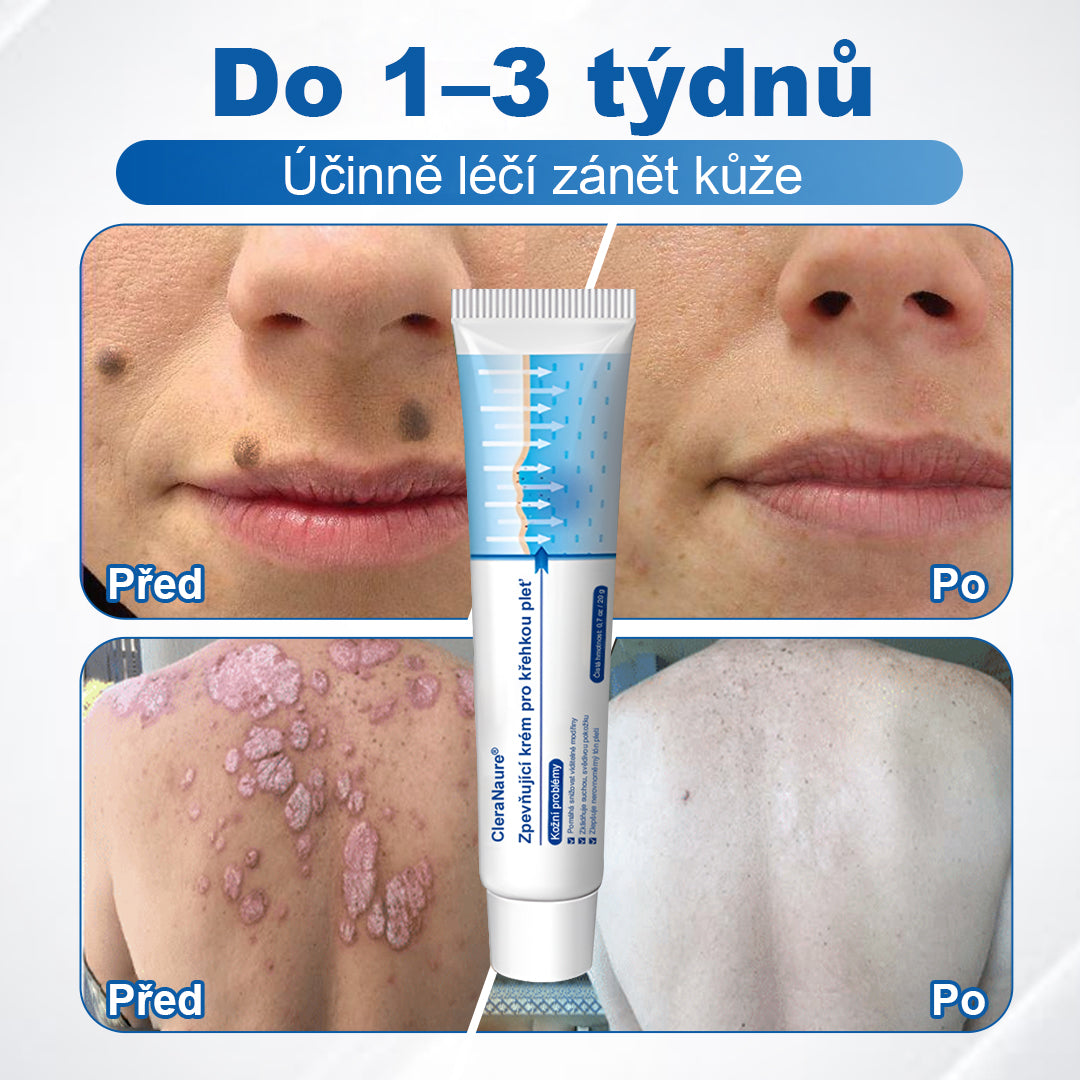 CleraNaure® – Regenerační krém pro oslabenou pleť 🛡️🌿 Multifunkční oprava proti modřinám, suchosti a skvrnám