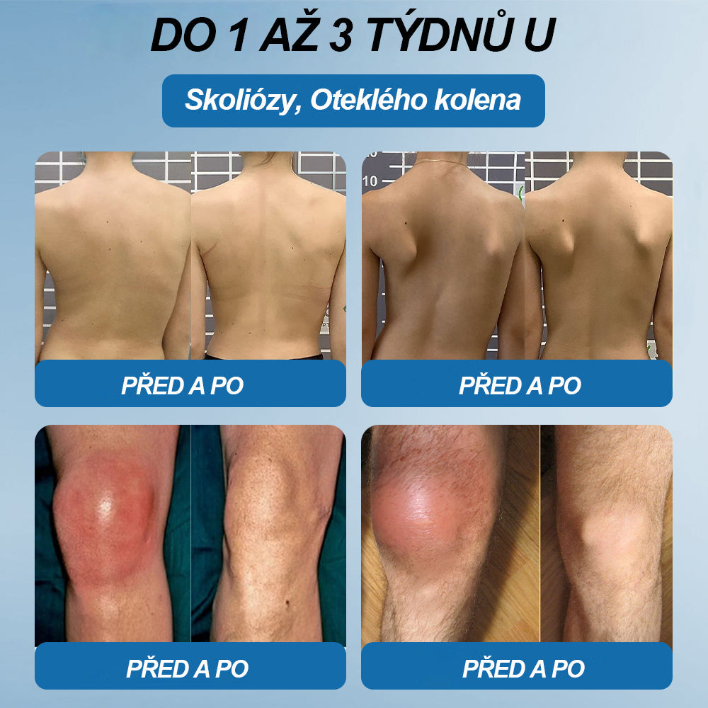 💎 Poslední den akce 80% SLEVA |  CleraNaure® BPC-157 Krém na hojení kloubů🦴Léčí artritidu, neuropatii, revmatismus, sportovní úrazy a další