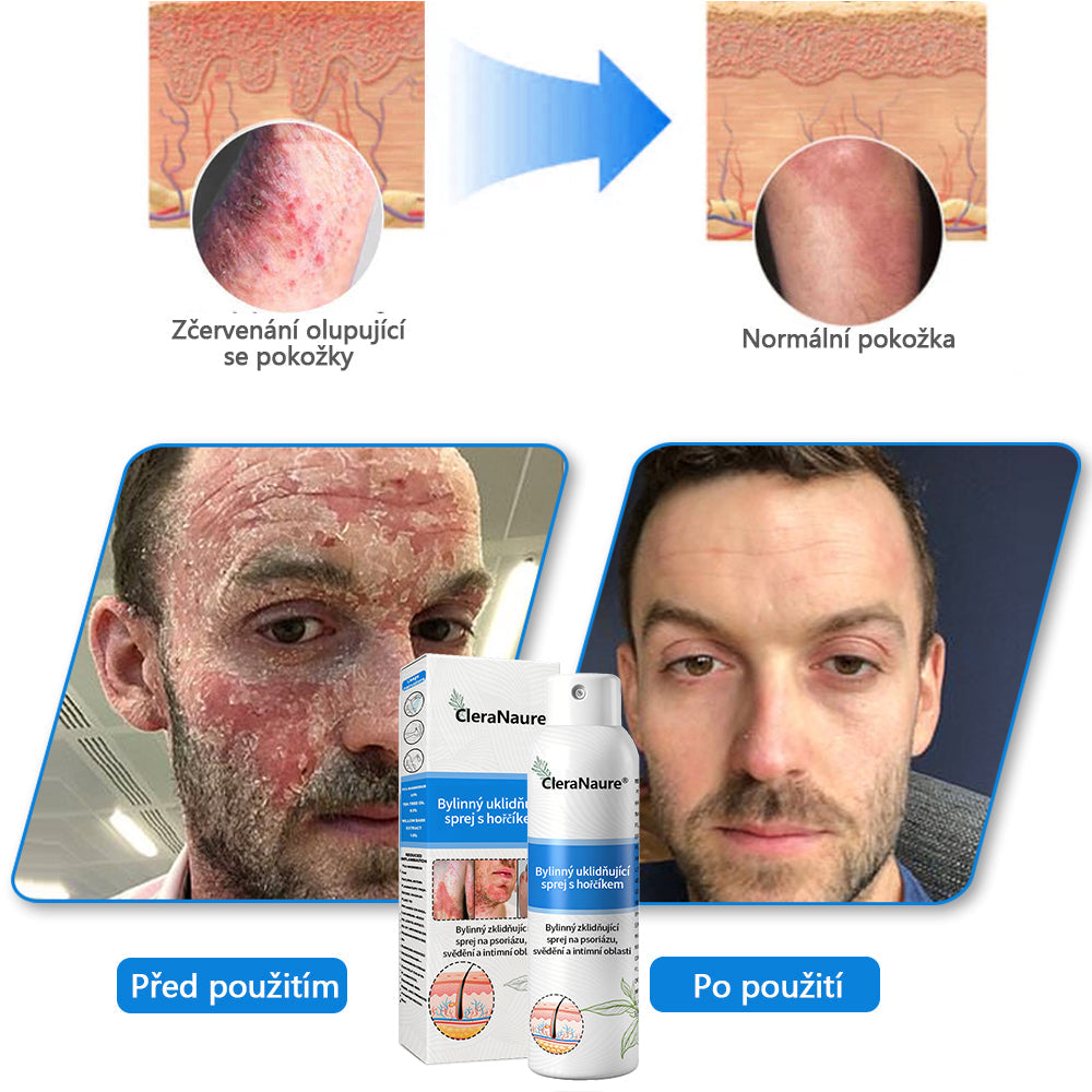 ❄️CleraNaure® Magnesium bylinný sprej