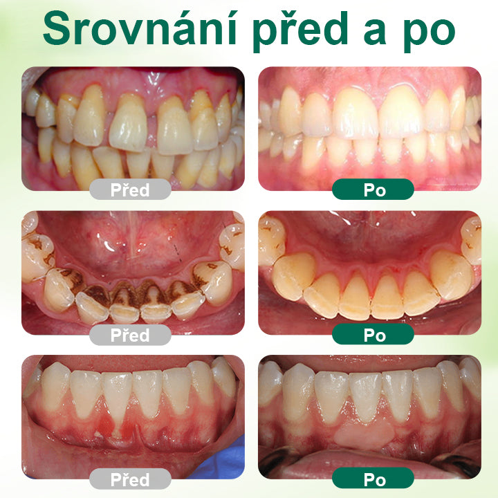 CleraNaure® Zero-Waste Mouth Tabs – bezodpadové ústní tablety