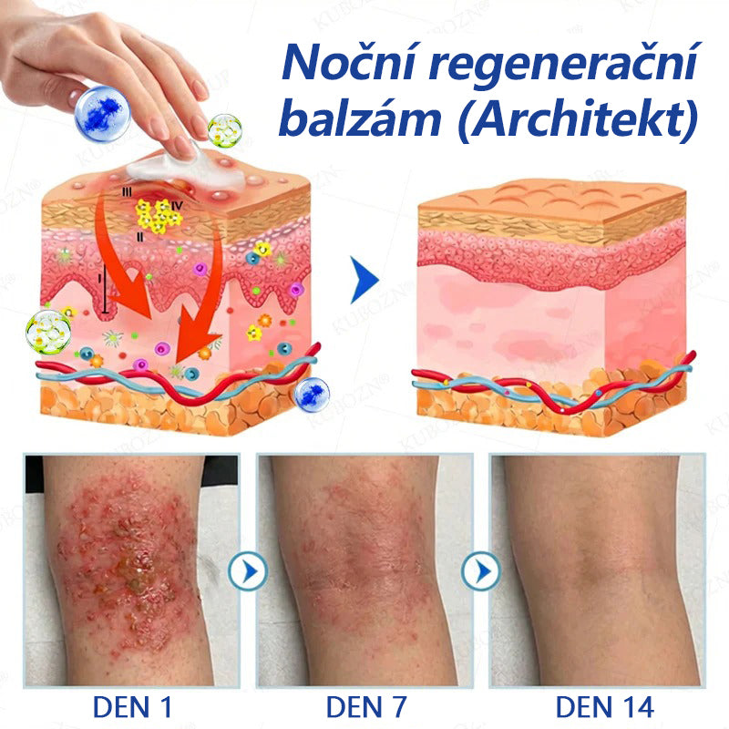CleraNaure® Systém pro denní a noční péči o ekzémy –⚡ dvojbalení bez steroidů pro úlevu od intenzivního svědění, zarudnutí a porušené pokožky (akční nabídka)- 🌻
