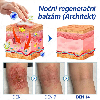 CleraNaure® Systém pro denní a noční péči o ekzémy –⚡ dvojbalení bez steroidů pro úlevu od intenzivního svědění, zarudnutí a porušené pokožky (akční nabídka)- 🌻