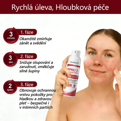 🔴CleraNature® Sprej s Hovězím Tvarohem pro Svědící, Olupující se Pokožku Při Psoriáze