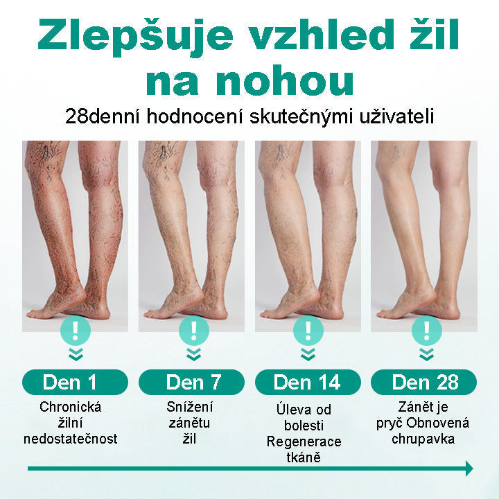 CleraNaure® LegRenew Náplast na Křečové Žíly