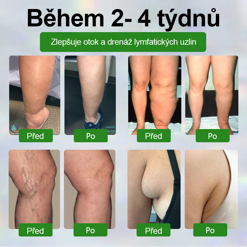 🌿Buzora® Bylinný krém zmírňující otoky s černuchou🎁