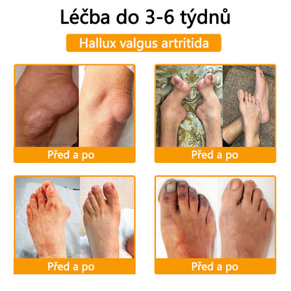 🛡️CleraNaure® Krém s včelím jedem pro úlevu od bolesti a hojení kostí