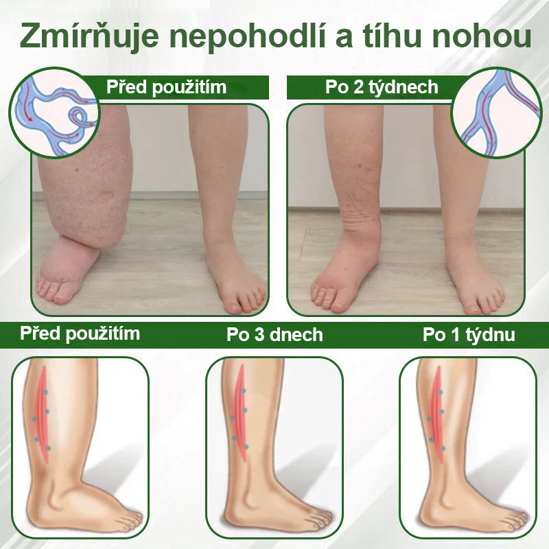 🌿Buzora® Bylinný krém zmírňující otoky s černuchou🎁