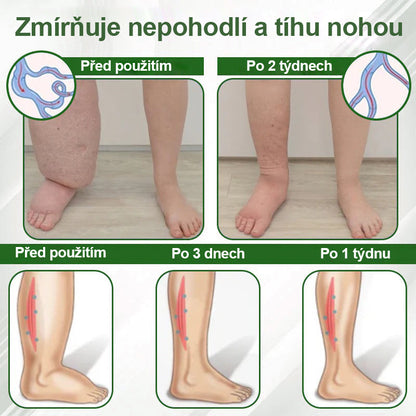 🌿Buzora® Bylinný krém zmírňující otoky s černuchou🎁