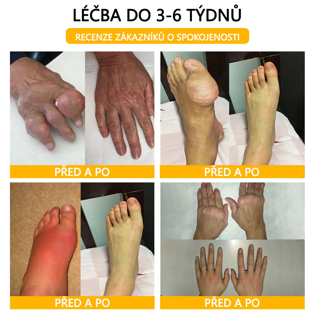 🫧CleraNaure® Krém s včelím jedem pro úlevu od bolesti a hojení kostí