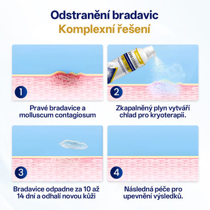 ❄️CleraNaure® ChillErase sprej na obnovu hrbolků✨