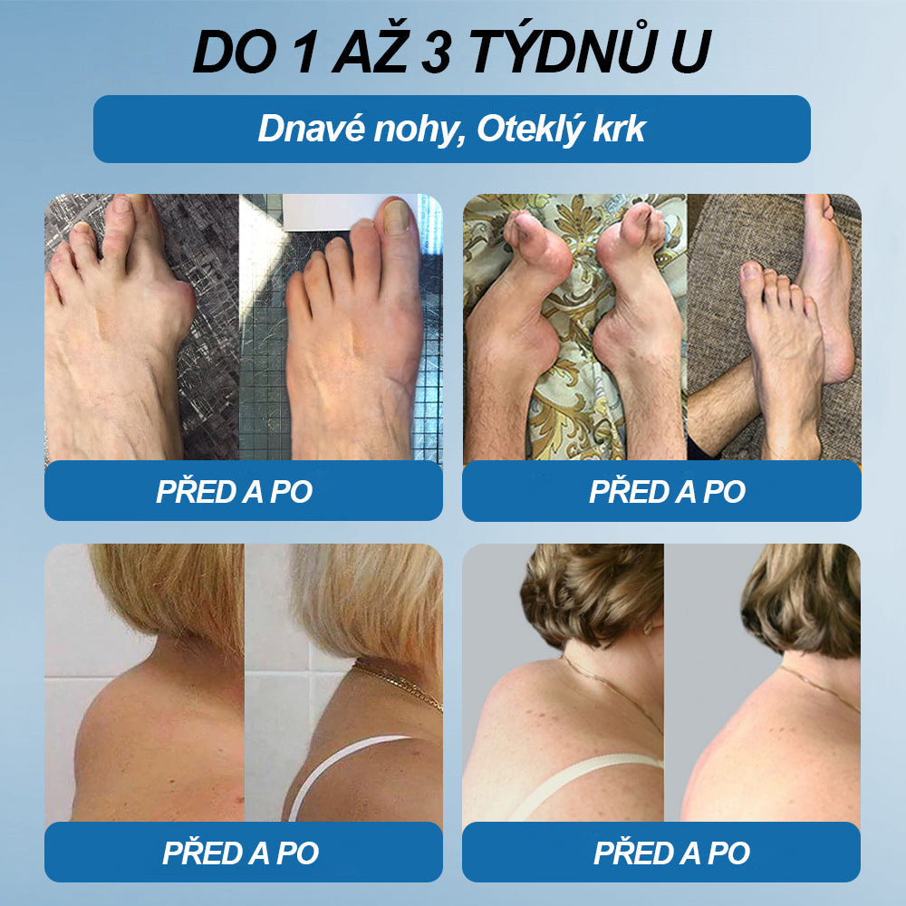 💎 Poslední den akce 80% SLEVA |  CleraNaure® BPC-157 Krém na hojení kloubů🦴Léčí artritidu, neuropatii, revmatismus, sportovní úrazy a další