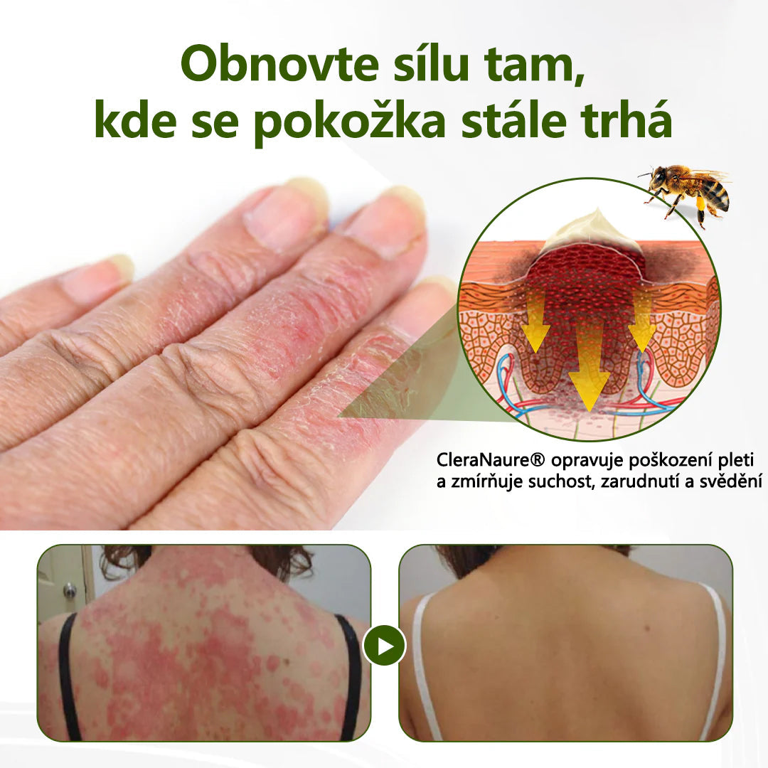 CleraNaure® BeePeptide RootSoft DualRelief krém