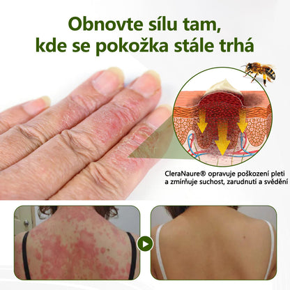 CleraNaure® BeePeptide RootSoft DualRelief krém