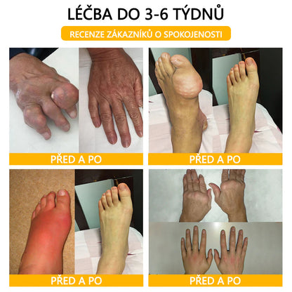 ⭐CleraNaure® Krém s včelím jedem pro úlevu od bolesti a hojení kostí