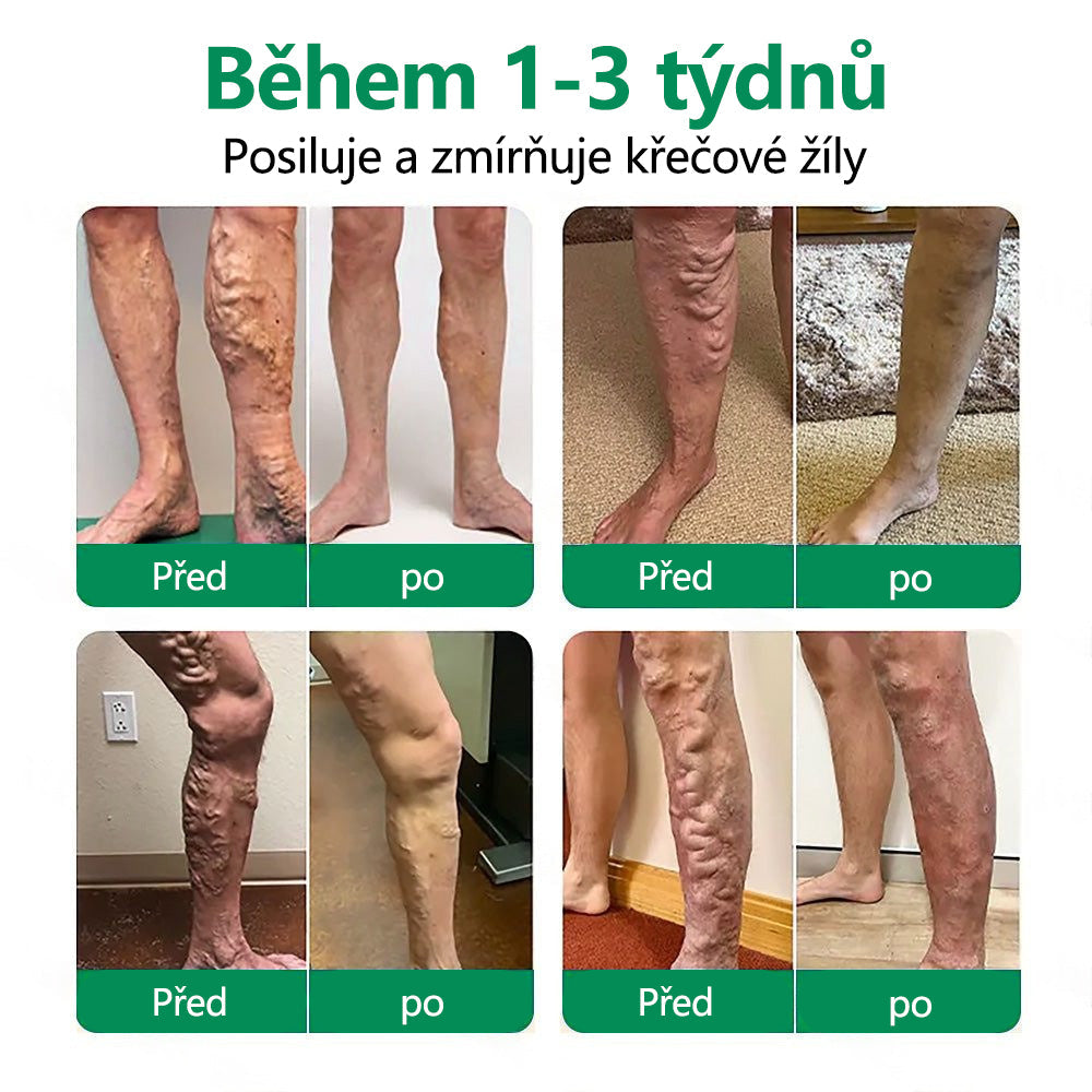 CleraNaure® VeinTarget Mikroneedling Obvaz