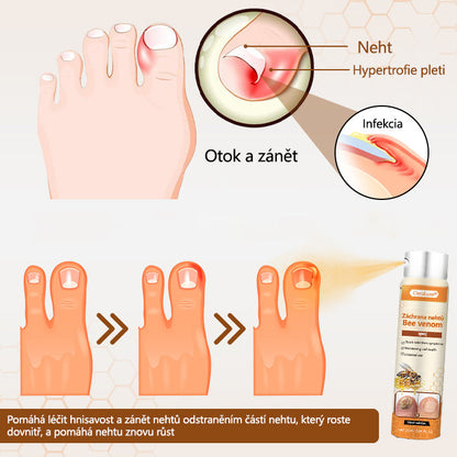✨CleraLuxe® NailRescue Včelí jed ve spreji