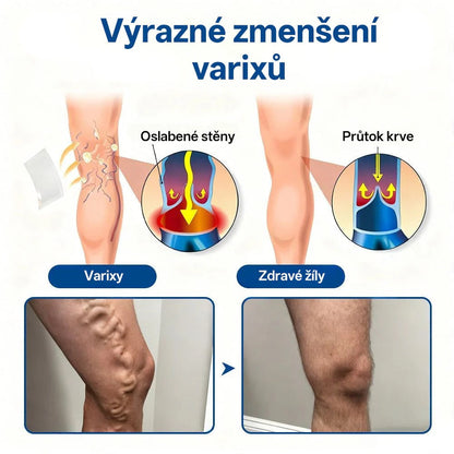 🛡️Healrize® VeinTarget Mikronedlové Náplasti✨