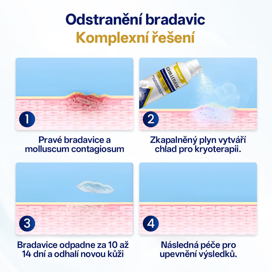 🫧CleraNaure® ChillErase sprej na obnovu hrbolků✨