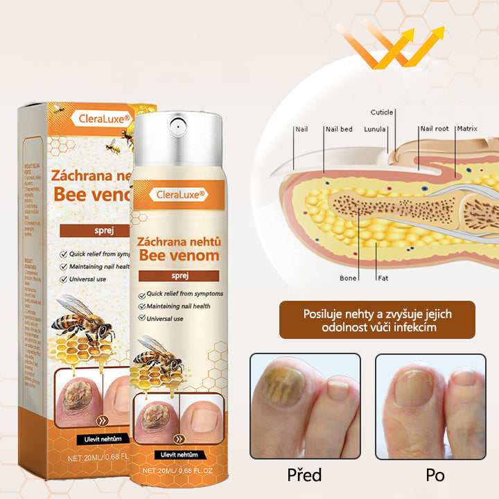 ✨CleraLuxe® NailRescue Včelí jed ve spreji