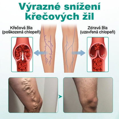 CleraNaure® LegRenew Náplast na Křečové Žíly