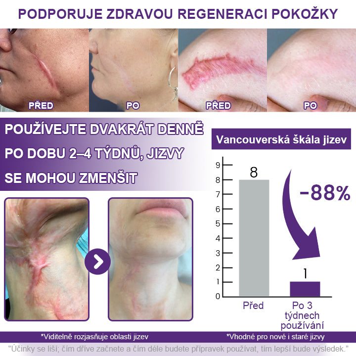 CleraNaure® ReGenScar – Regenerační gel na jizvy s kmenovými buňkami
