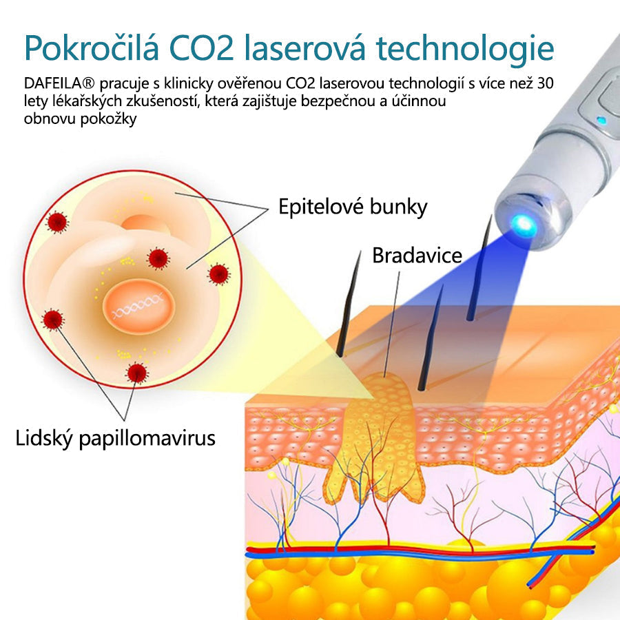 DAFEILA® LumeSkin – laserové pero pro odstraňování znamének a bradavic
