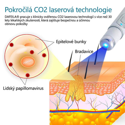DAFEILA® LumeSkin – laserové pero pro odstraňování znamének a bradavic